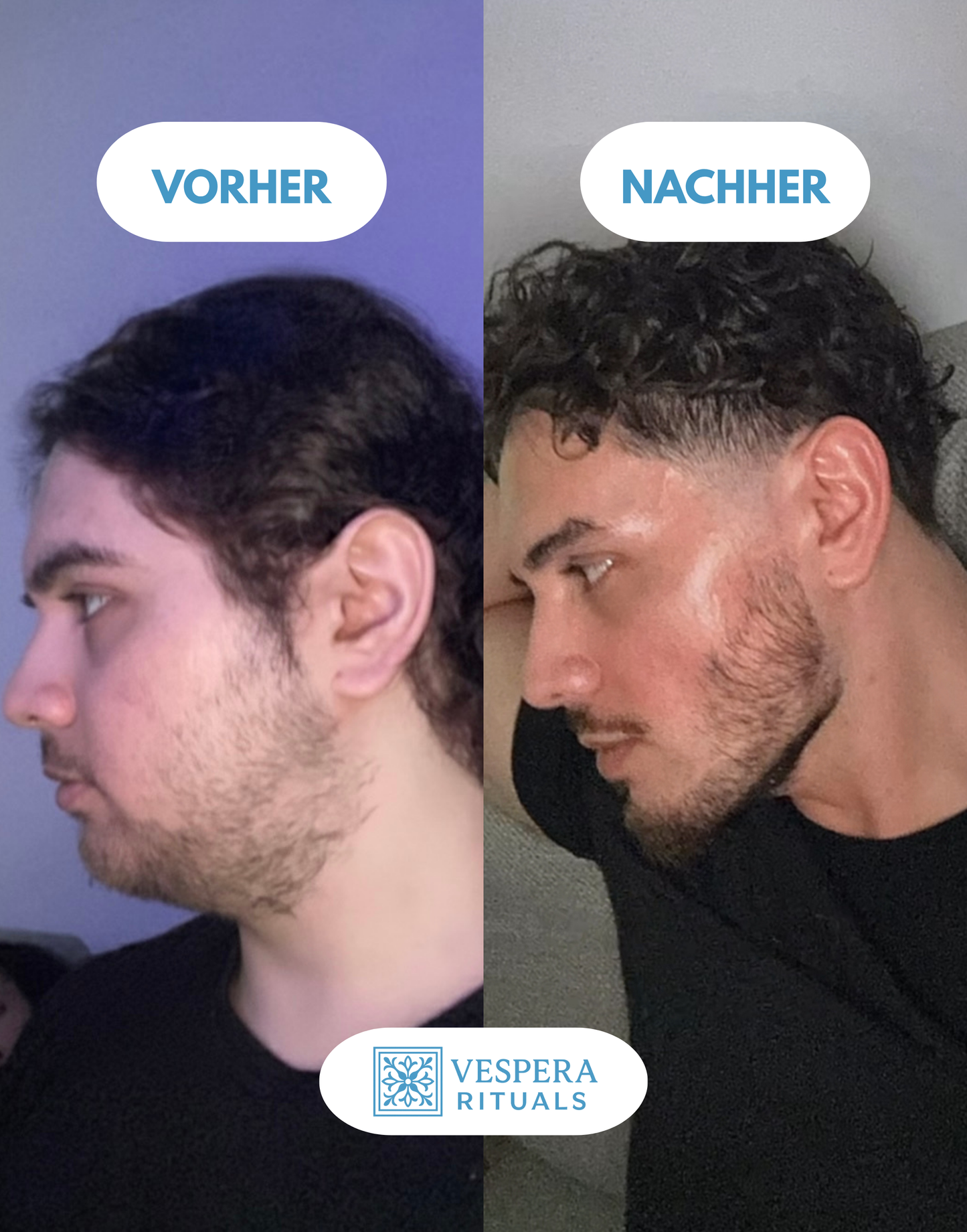 Vespera Clear & Lift™