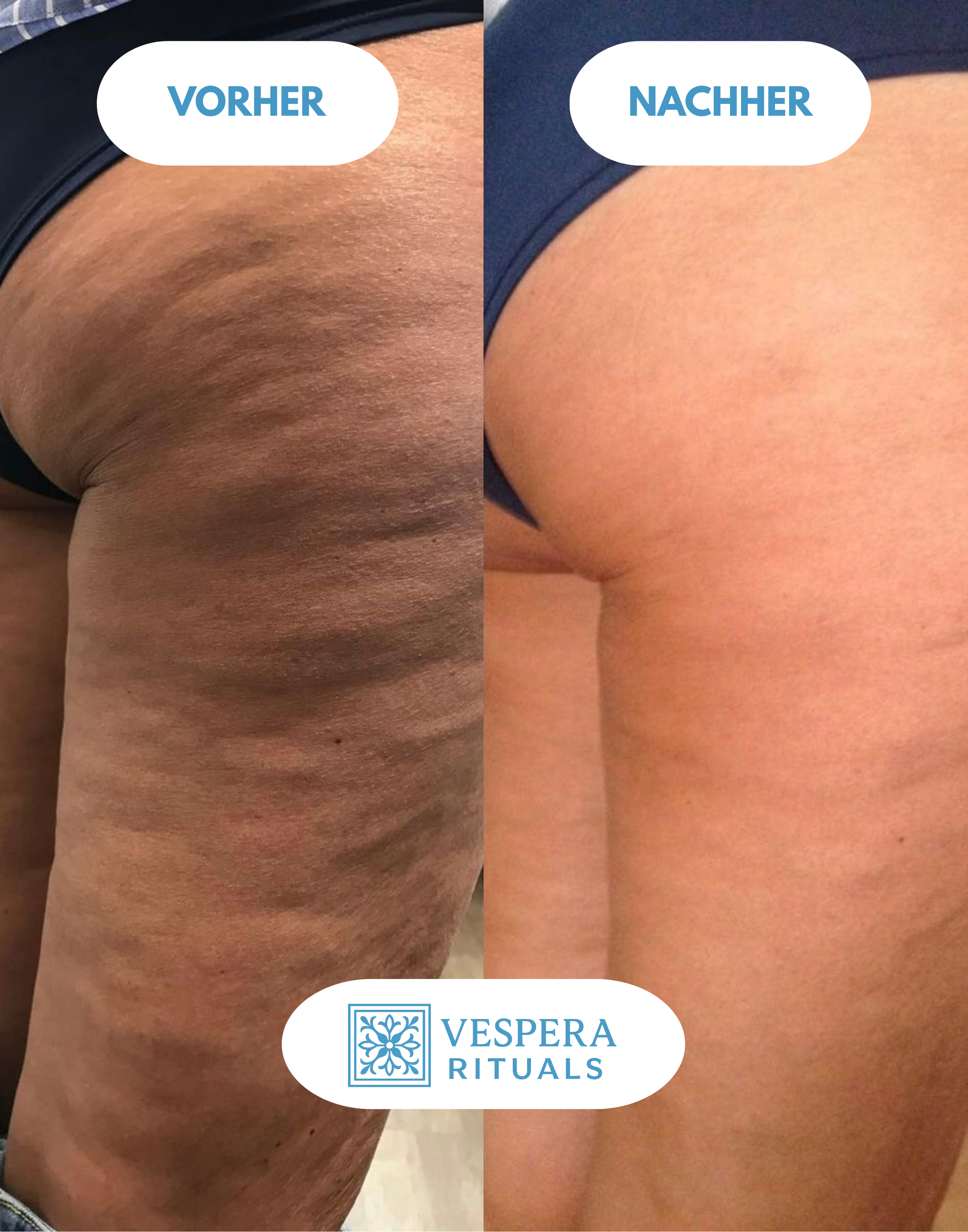 Vespera Sculpt & Firm™