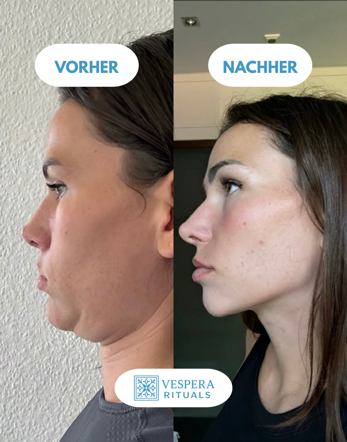 Vespera Clear & Lift™