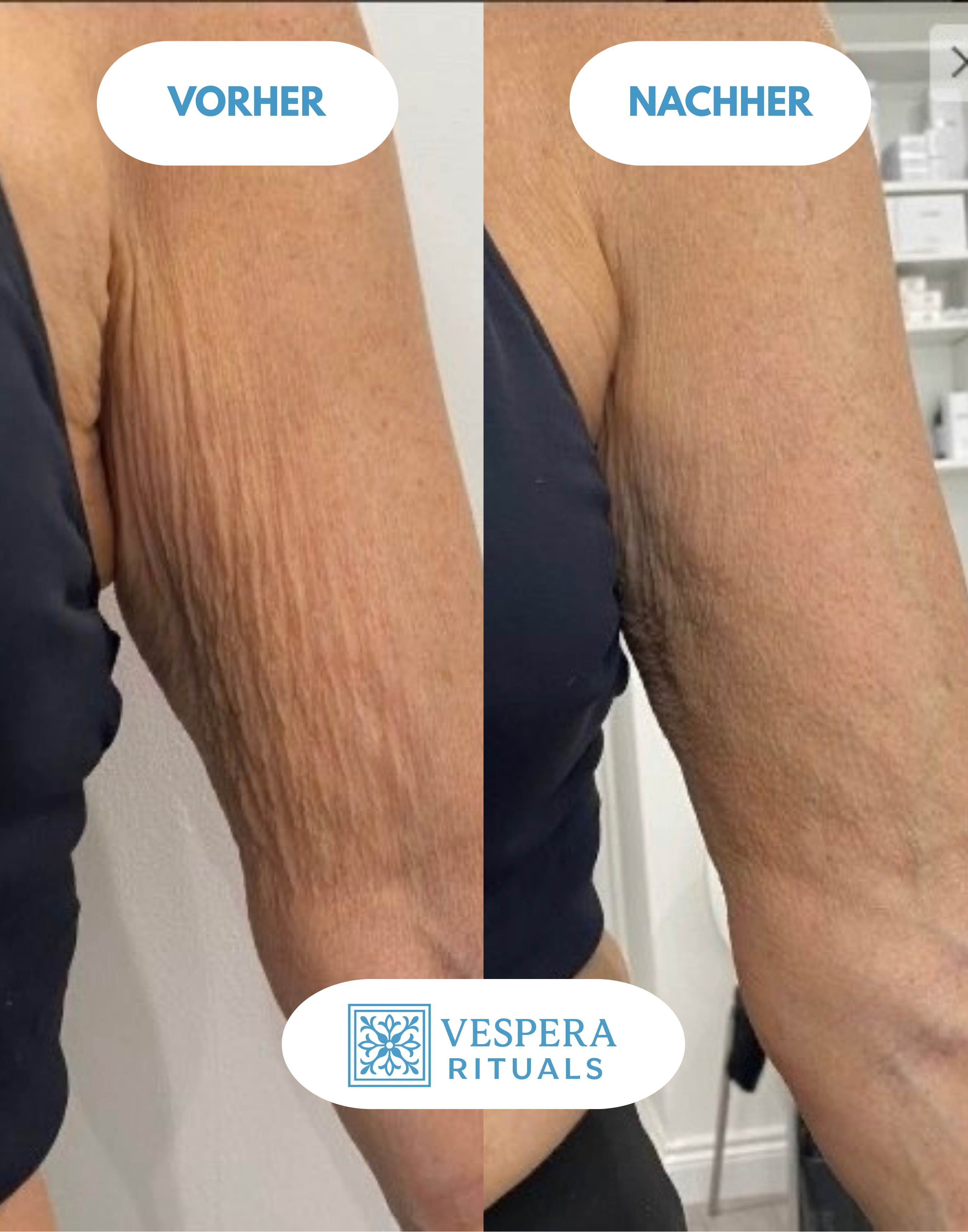 Vespera Sculpt & Firm™
