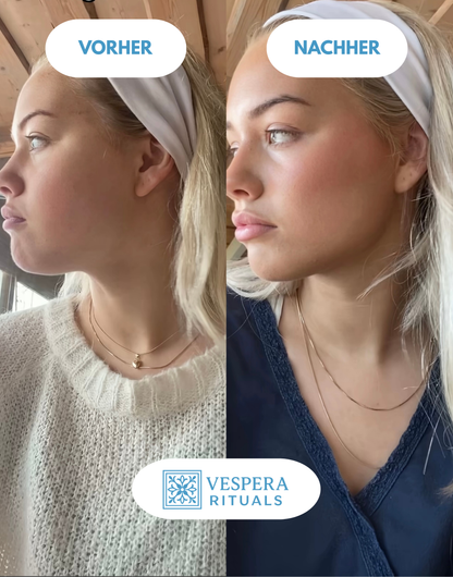 Vorher und nachher: ​​Anwendung von Vespera Clear Lift im Gesicht